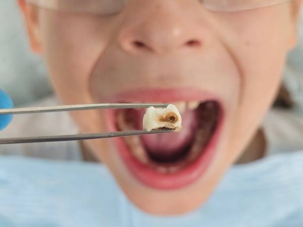 Best Urgent Dental Care for Toothache in Marion, KS