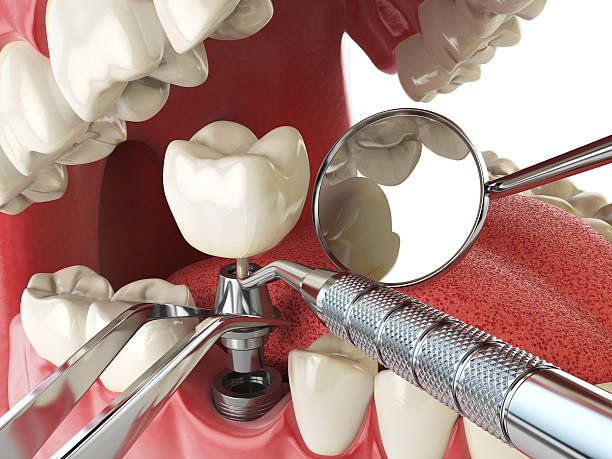 Best Emergency Dental Care for Abscessed Tooth in Marion, KS